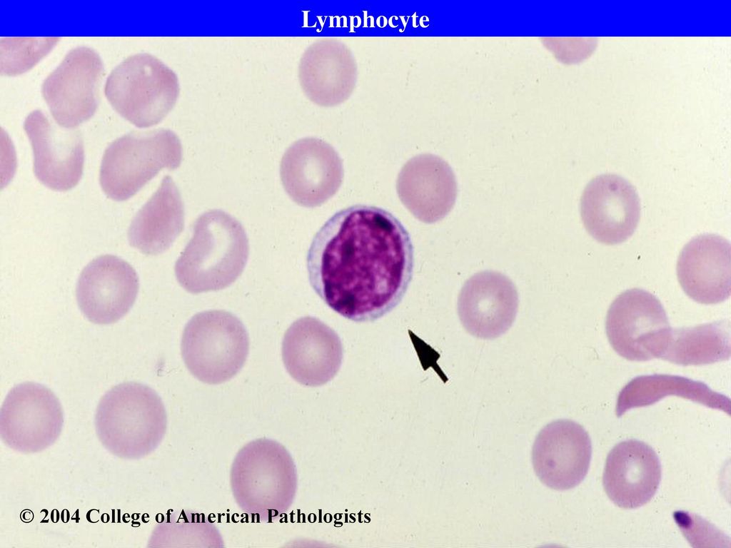 college american pathology