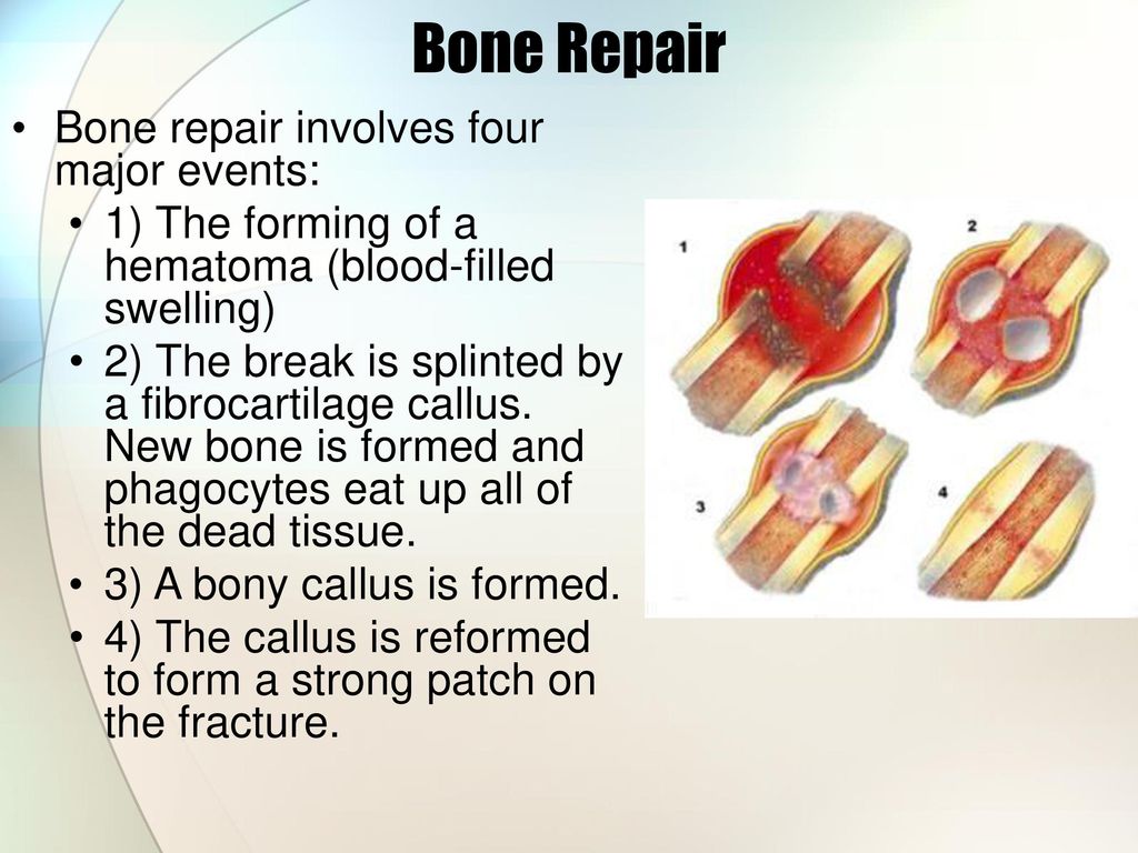 A v repair
