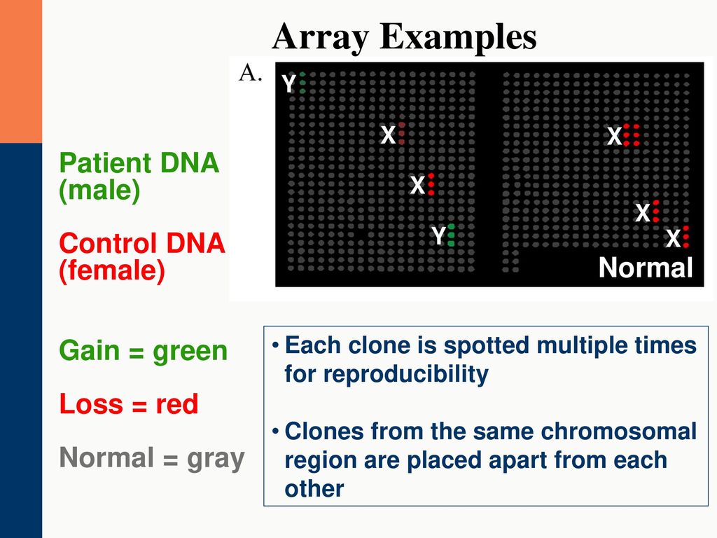 Array Examples Patient DNA (male) Control DNA (female) Gain = green