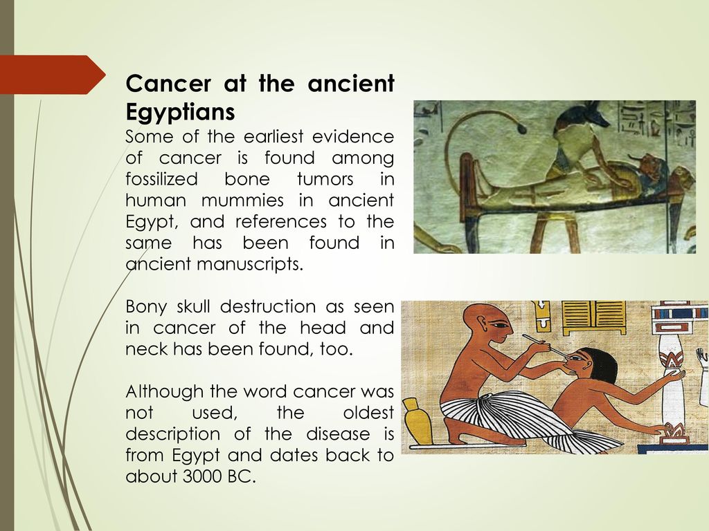 Image result for cancer in egyptian mummy pic