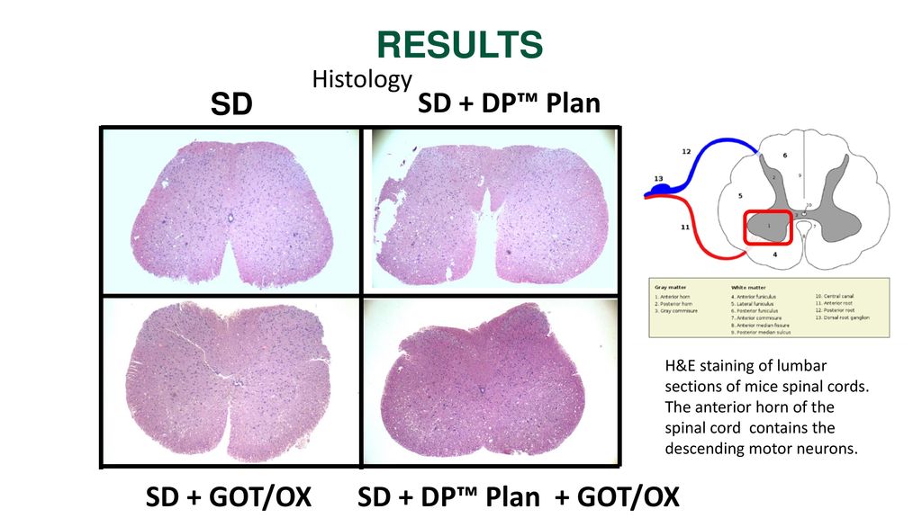 RESULTS SD SD + DP™ Plan SD + GOT/OX SD + DP™ Plan + GOT/OX Histology