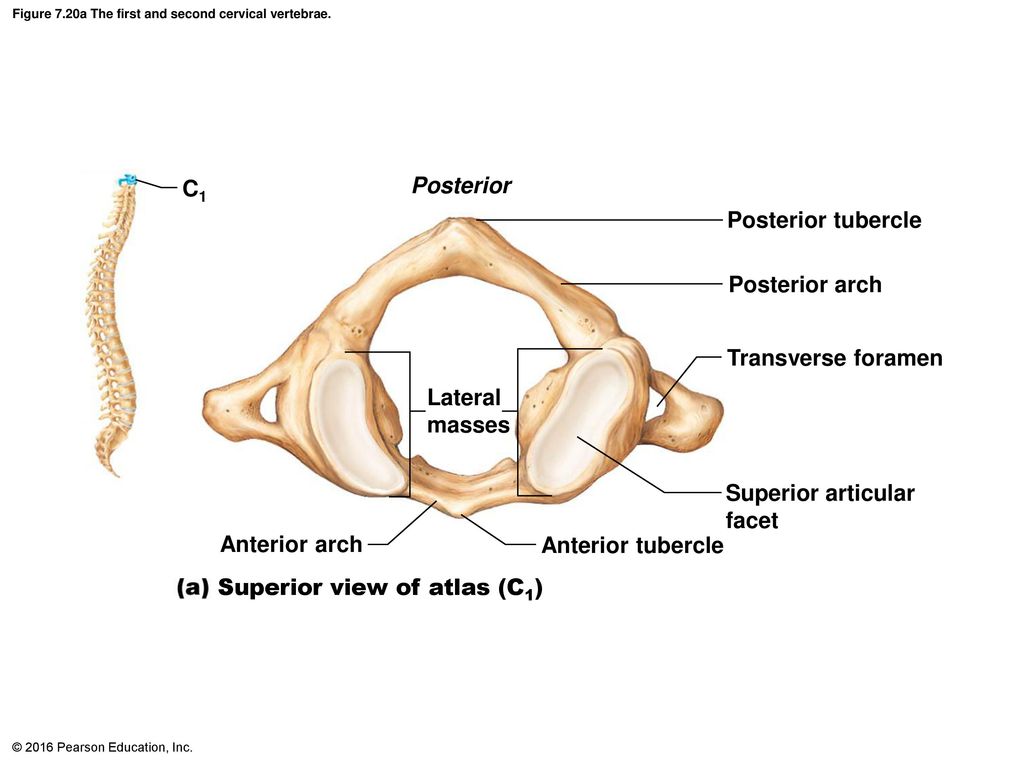 The first of these the second. Atlas c1. C1 vertebrae. Atlas-os / Atlas. Постериор риноррхеа.