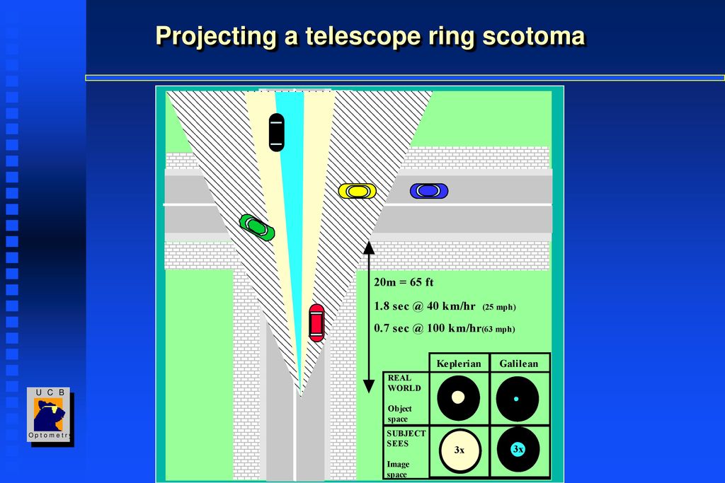 Projecting a telescope ring scotoma