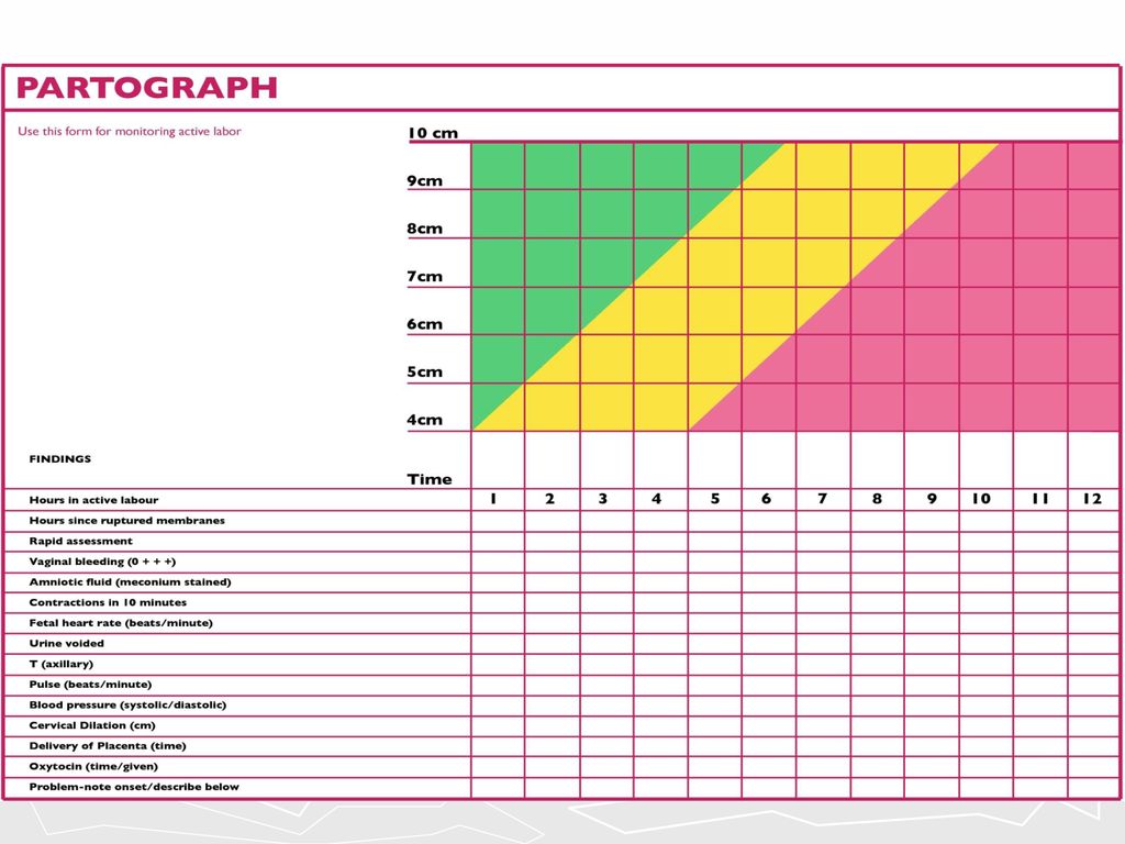 This is the SIMPLIFIED WHO partograph and the one that we will be using during this training.