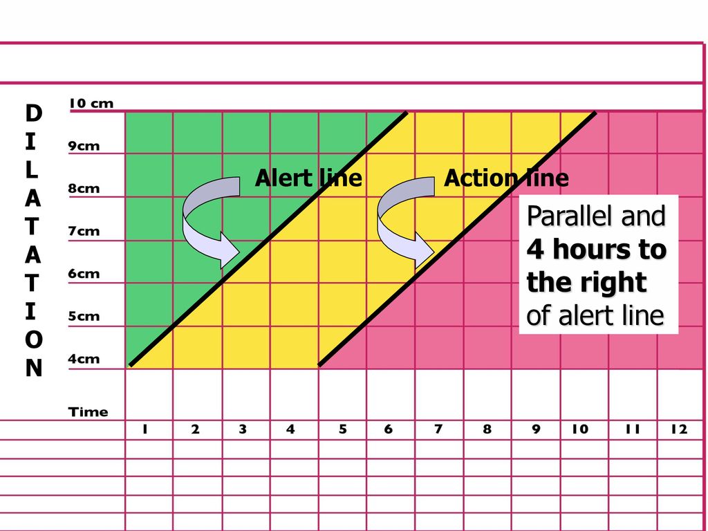 Parallel and 4 hours to the right of alert line