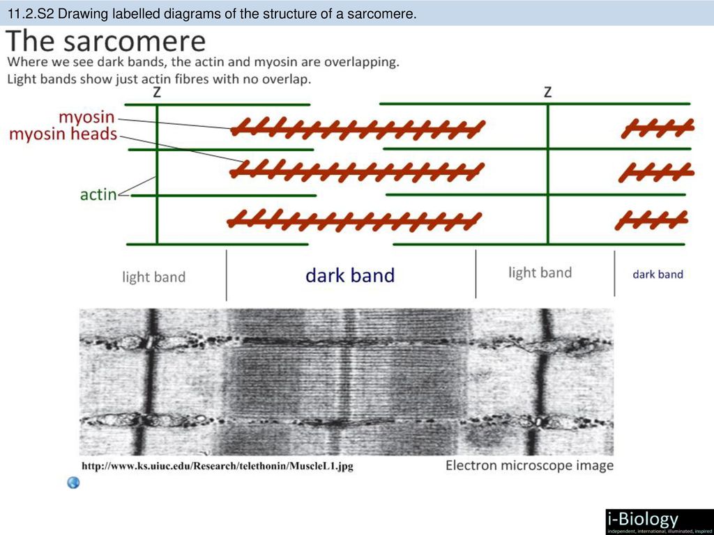 Match the labels on the diagram. Sarcomere structure. Label the diagram. Diagram labelling Listening Test.