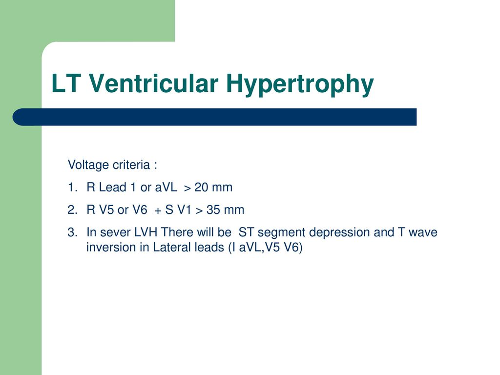 Electrocardiogram ECG - ppt download