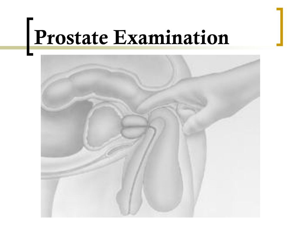 Csi 202 skills lab 6 gu foley catheterization breast testicular