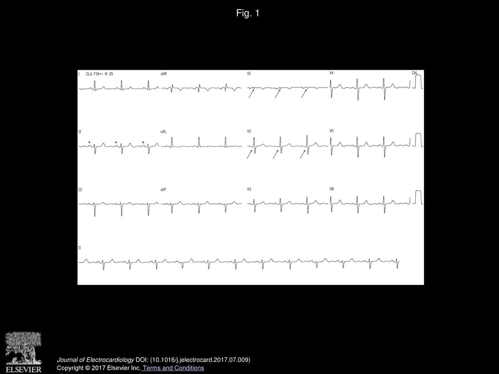 Journal of Electrocardiology ppt download