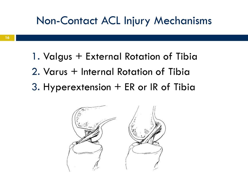 Knee Anatomy, Pathomechanics, Evaluation, & Treatment - ppt download