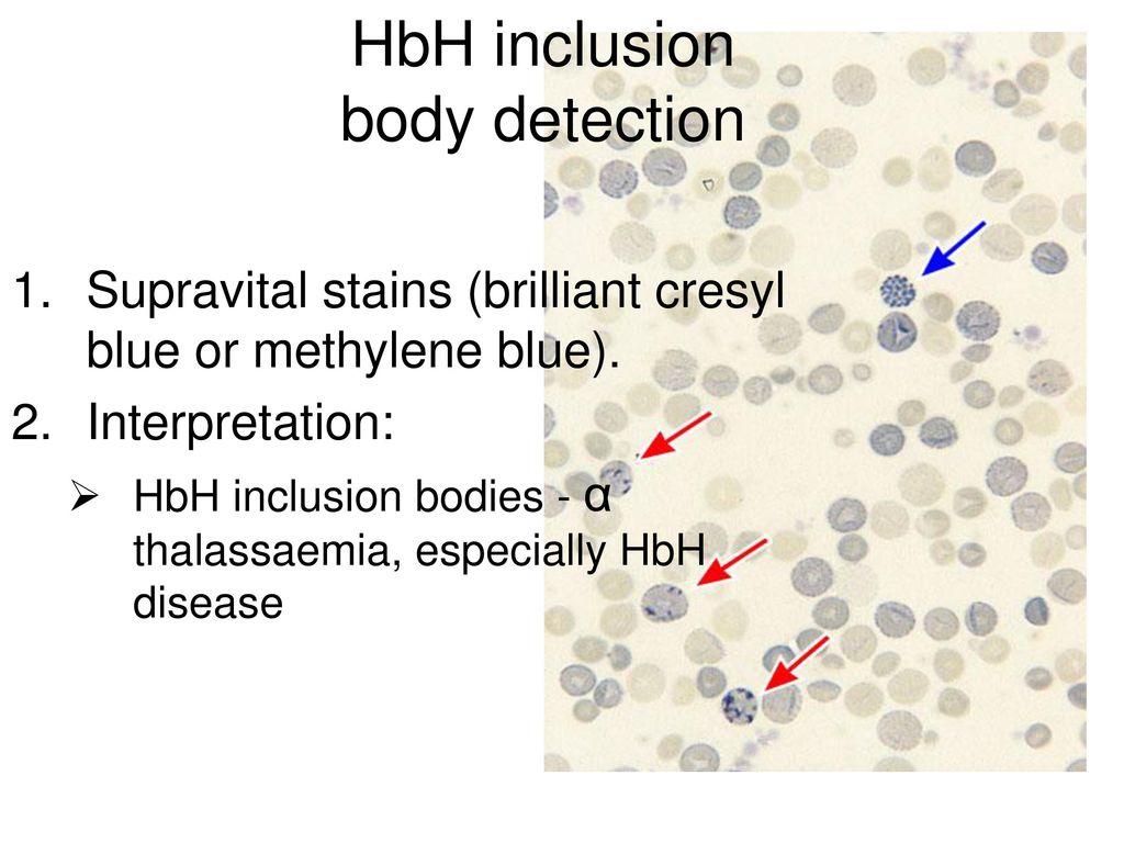 hbh inclusion bodies