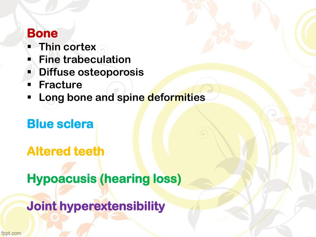 Hypoacusis (hearing loss) Joint hyperextensibility