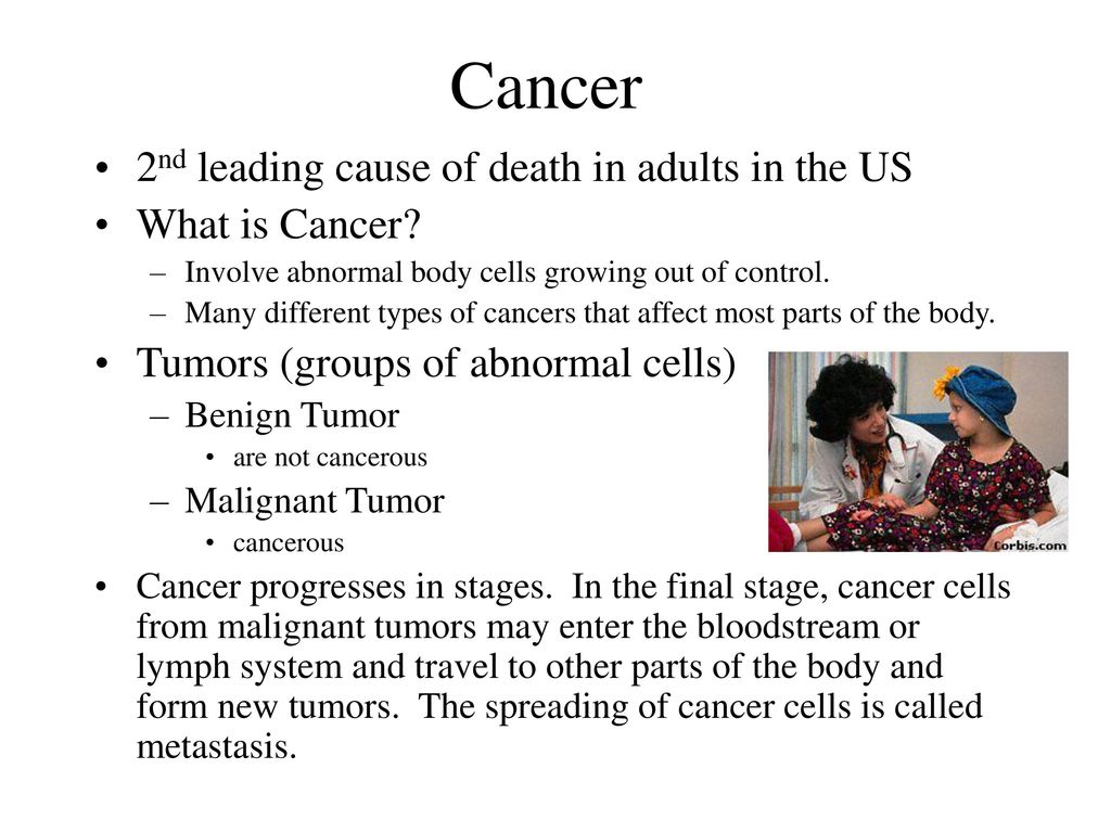 Cancer 2nd Leading Cause Of Death In Adults In The US What Is Cancer 