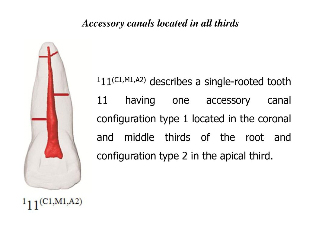 BRIEF NOTE New System For Classifying Root And Root Canal Morphology ...