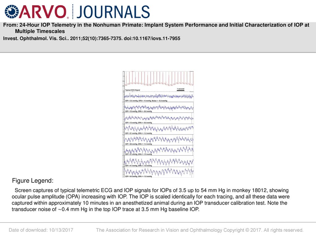 From: 24-Hour IOP Telemetry in the Nonhuman Primate: Implant System Performance and Initial Characterization of IOP at Multiple Timescales