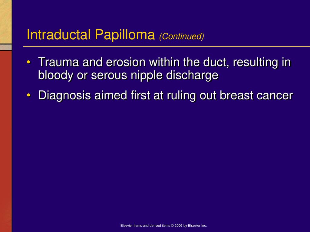 Intraduktális papilloma - Intraductalis papilloma bal oldali icd 10