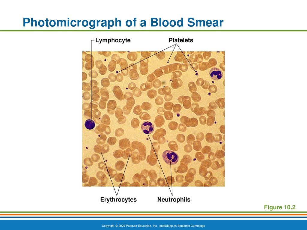 Photomicrograph of a Blood Smear
