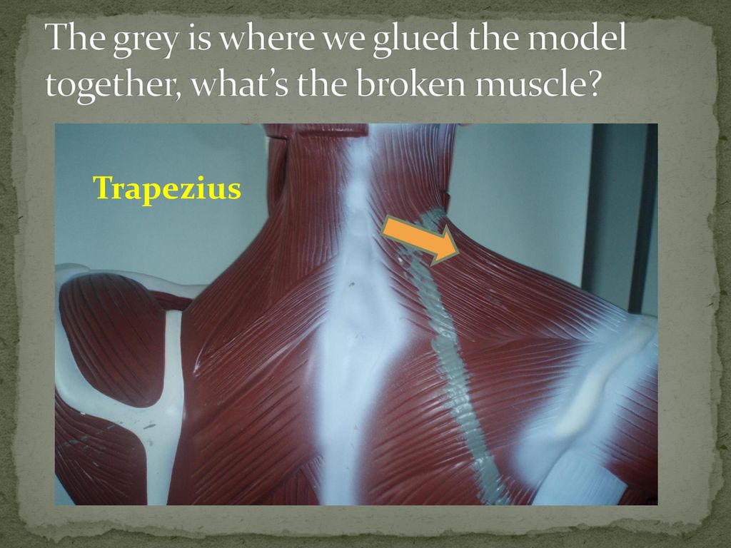 The grey is where we glued the model together, what’s the broken muscle