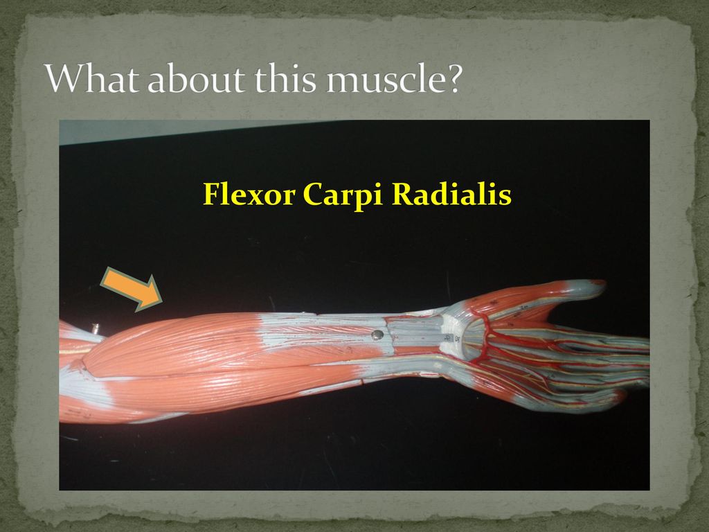 What about this muscle Flexor Carpi Radialis