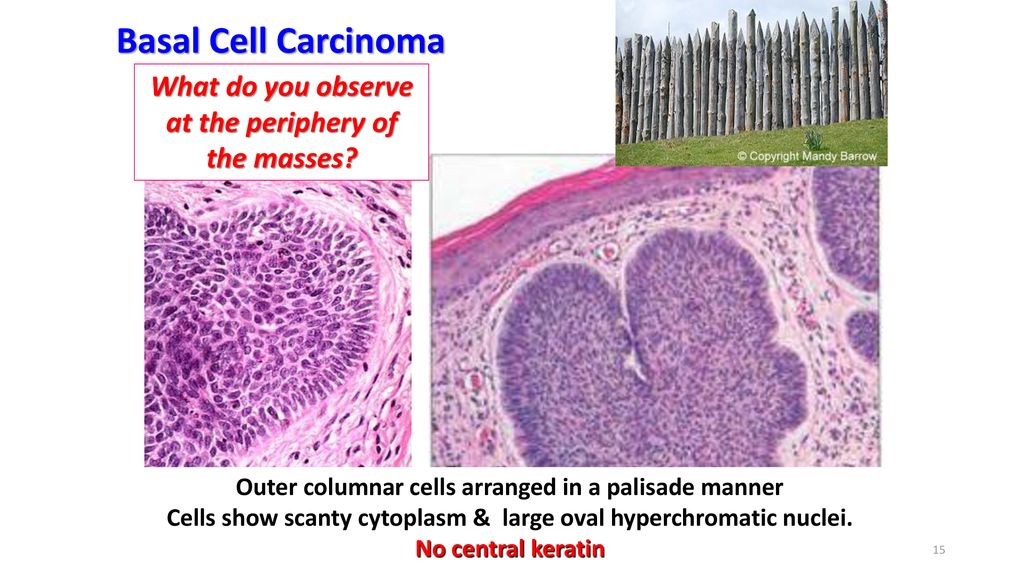 Classification Of Tumours Professor Of Pathology Ppt Download