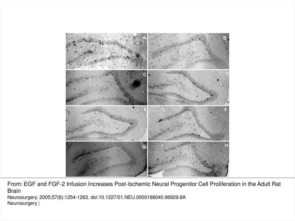 FIGURE 4. Representative photomicrographs showing the BrdUrd-positive cells in the ipsilateral DG of the four groups of rats at the end of 5 days (left panels) and 3 weeks of reperfusion (right panels). A, (5 d) and B, (3 wk) are the MCAO/growth factor group; C, (5 d) and D, (3 wk) are the MCAO/aCSF group; E, (5 d) and F, (3 wk) are the sham/growth factor group; and G, (5 d) and H, (3 wk) are the sham/aCSF group.