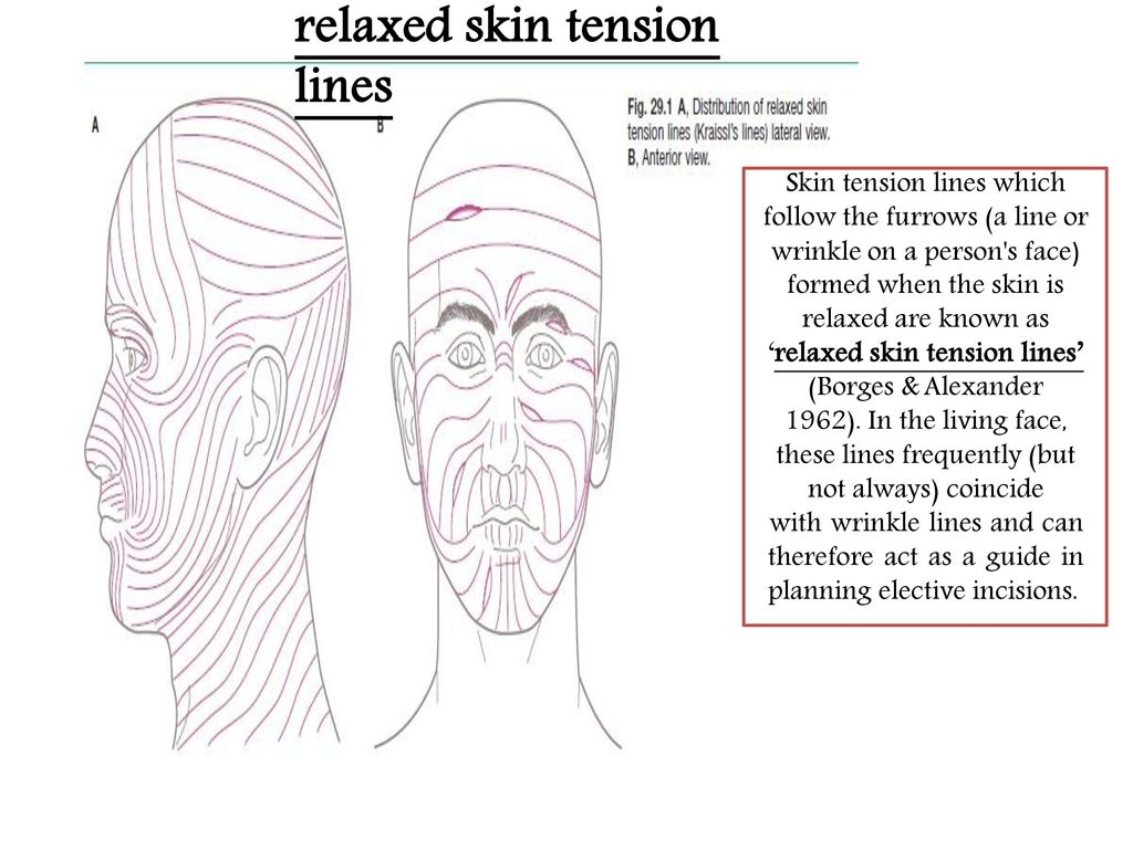 The Face 1-Skin of the Face The skin of the face is: Elastic - ppt download