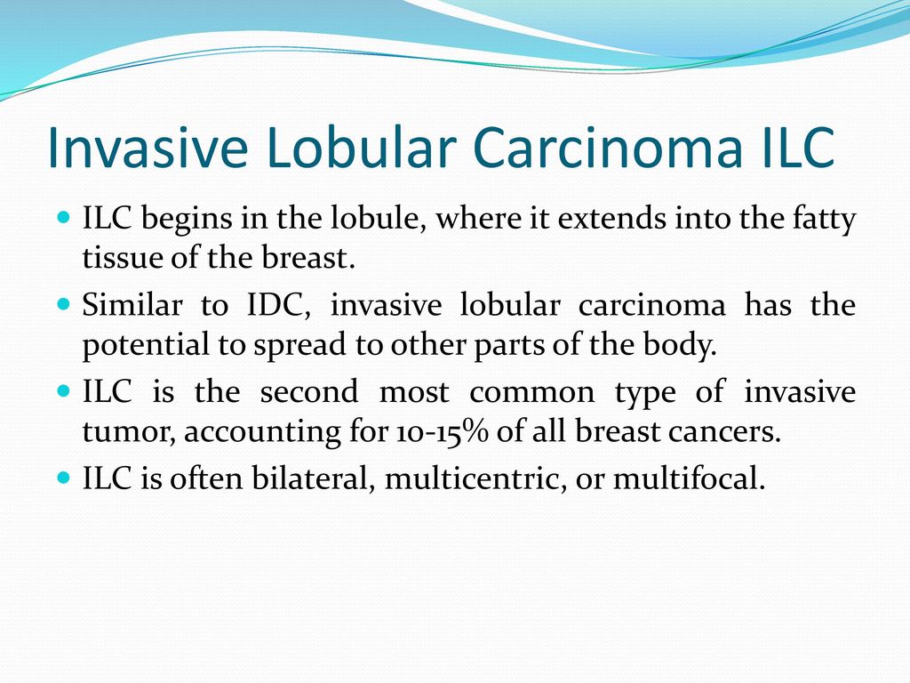 Invasive Lobular Carcinoma ILC