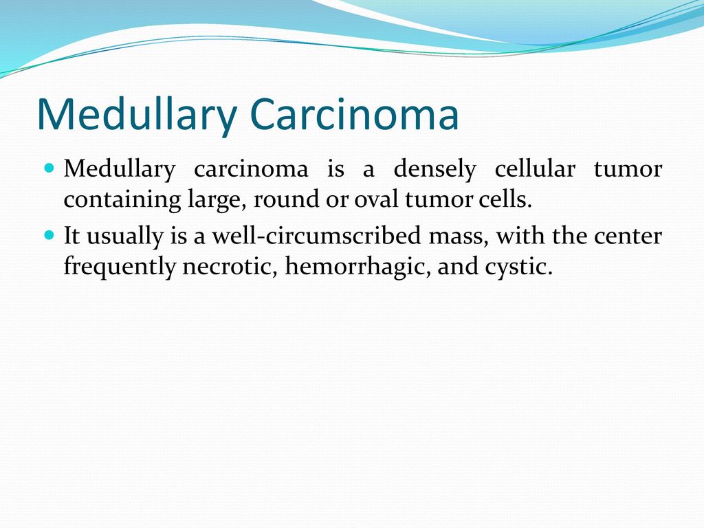 Medullary Carcinoma Medullary carcinoma is a densely cellular tumor containing large, round or oval tumor cells.