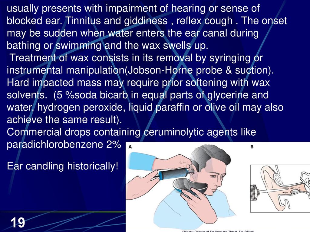 usually presents with impairment of hearing or sense of blocked ear