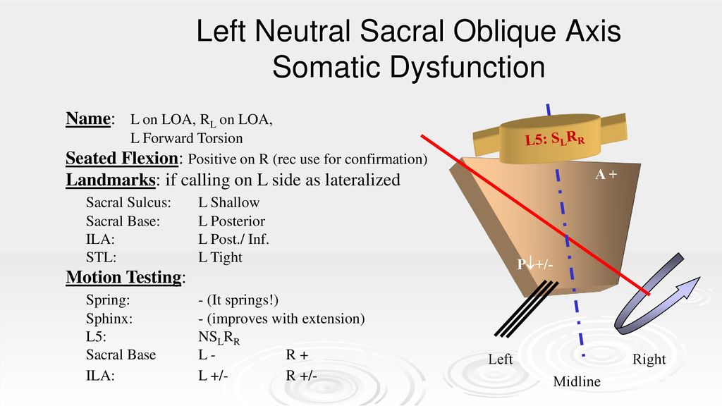 Sacral Diagnoses Stuart Williams D O Chairman Associate Professor Ppt Download