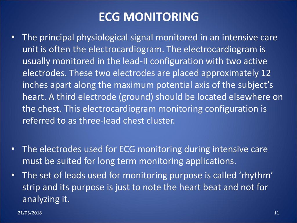 ECG MONITORING
