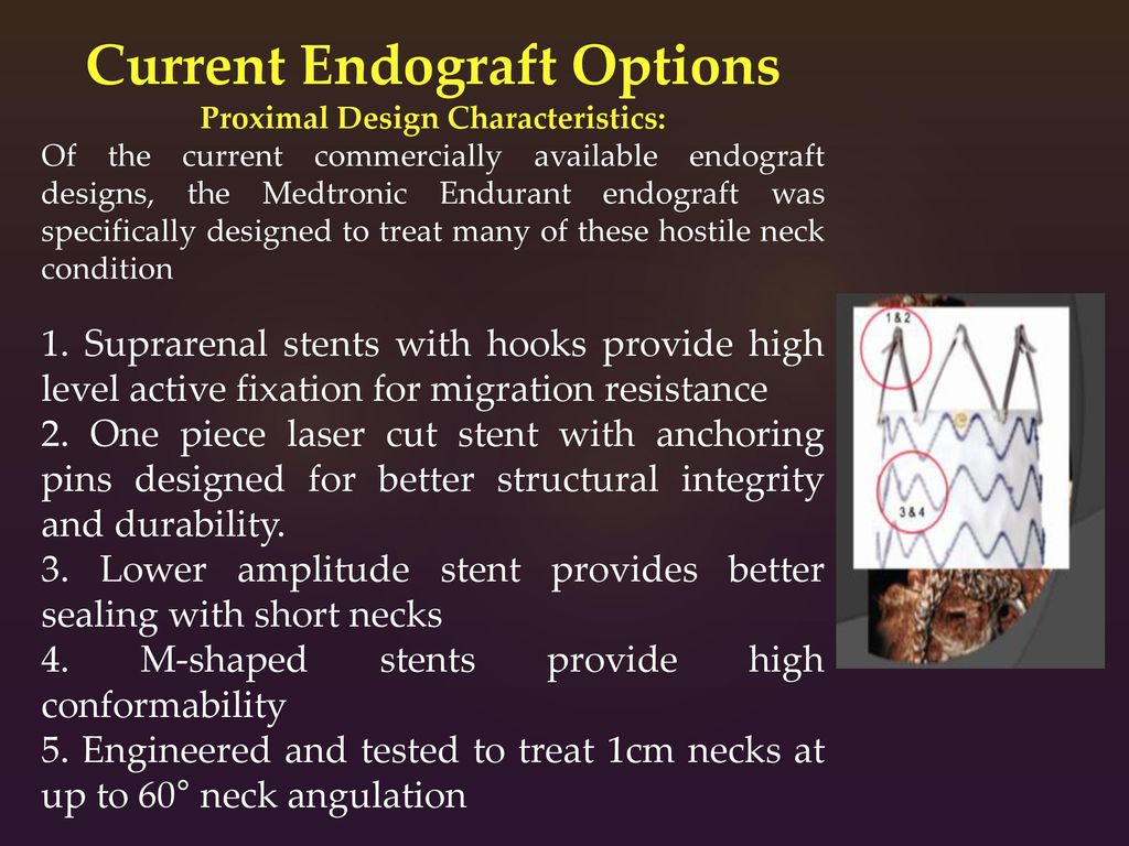 Current Endograft Options Proximal Design Characteristics:
