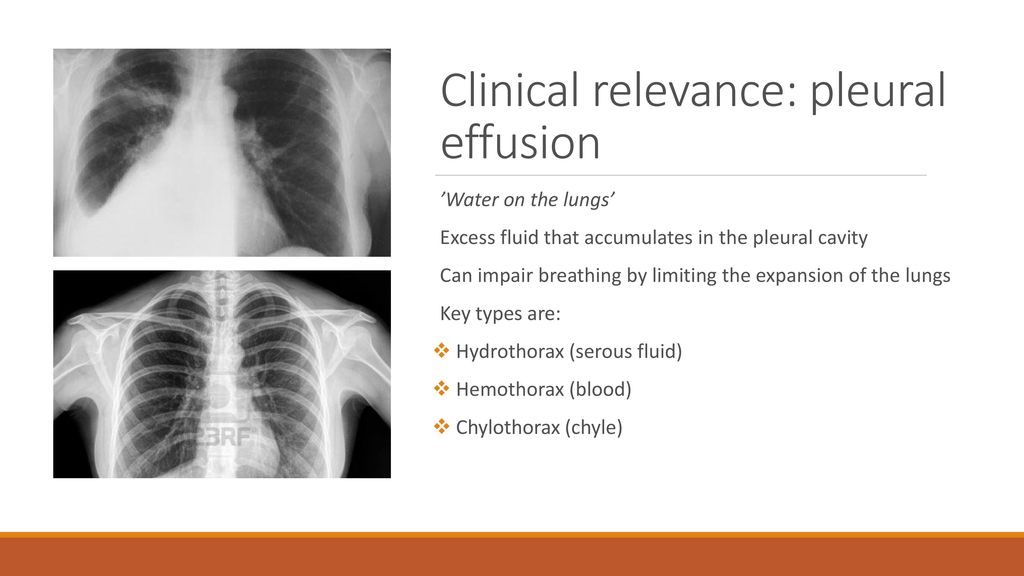 Surface anatomy, lung markings and pleural reflections - ppt download