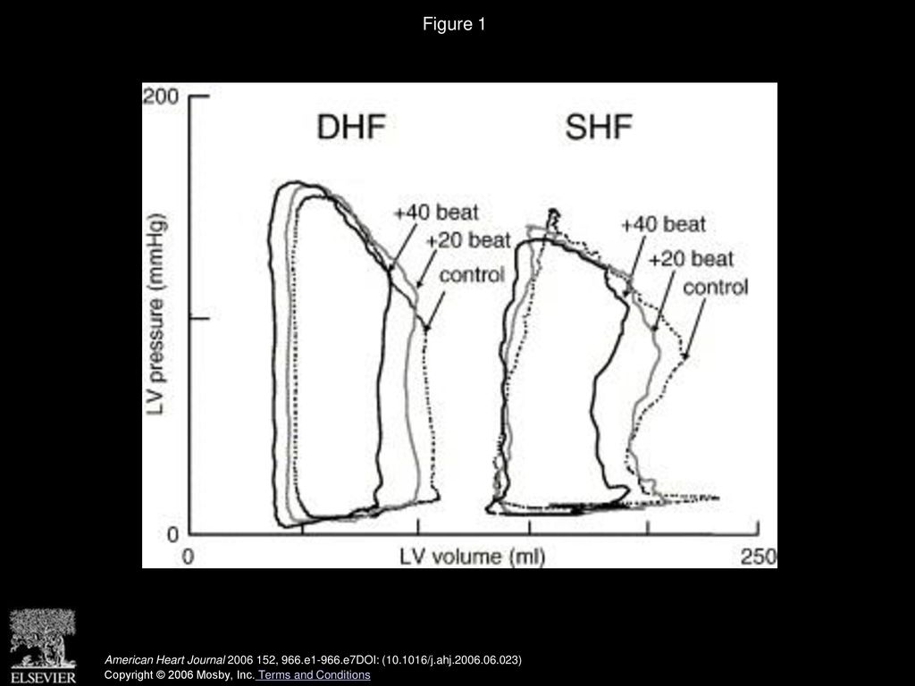 Figure 1 Representative LV pressure-volume loops from patients with SHF and DHF when atrial pacing was increased by 20 and 40 beat/min.