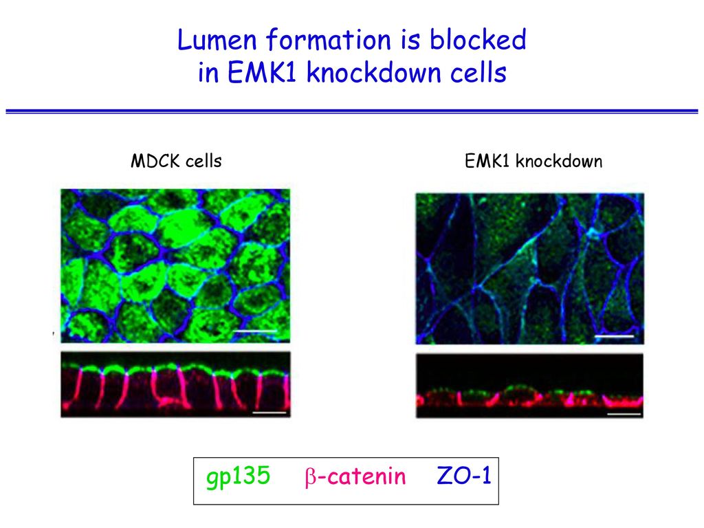 Lumen formation is blocked in EMK1 knockdown cells