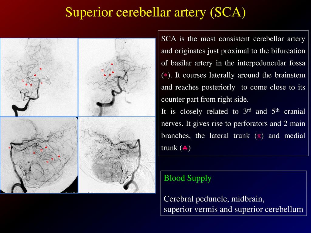 POSTERIOR FOSSA STROKE vascular syndromes with MRI correlation - ppt ...