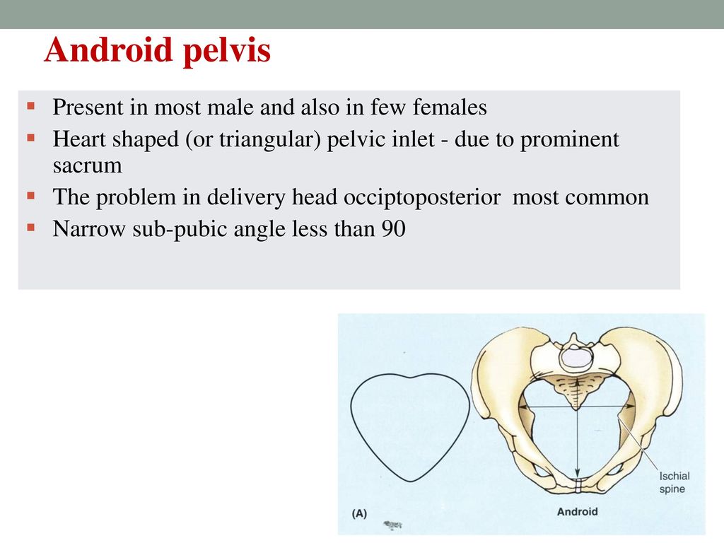 Heart shaped (or triangular) pelvic inlet - due to prominent sacrum. 