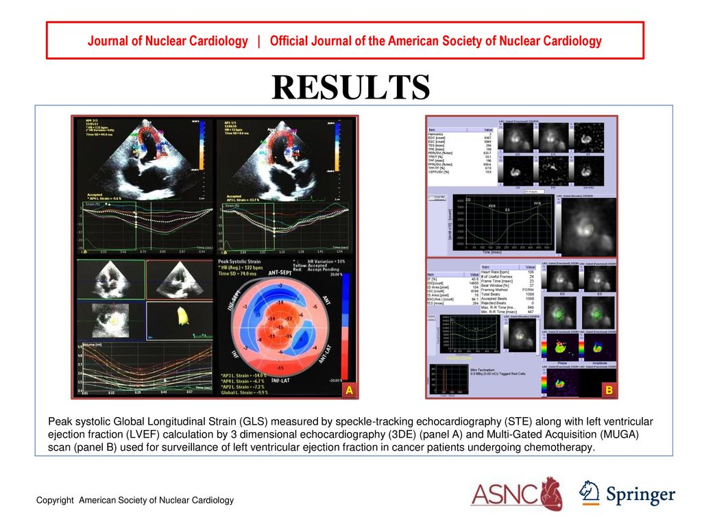 Journal of Nuclear Cardiology | Official Journal of the American Society of Nuclear Cardiology