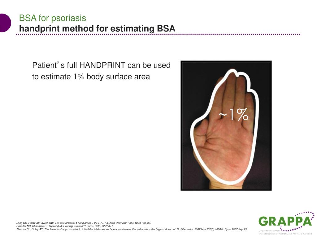 body surface area assessment psoriasis