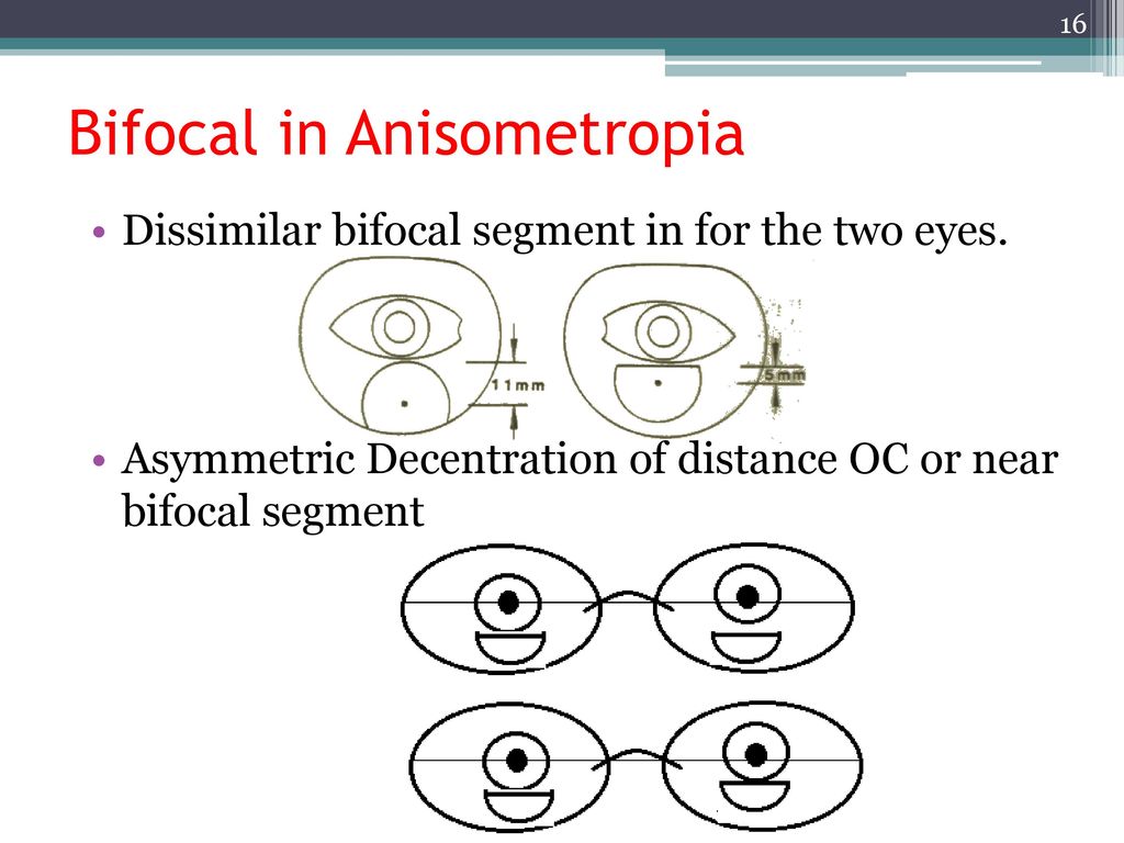 Prescribing Guidelines for Bifocals and PALs - ppt download