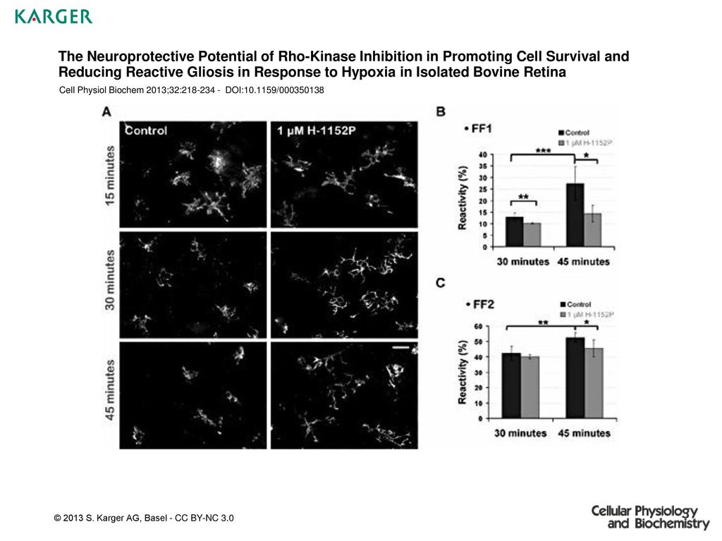 The Neuroprotective Potential of Rho-Kinase Inhibition in Promoting Cell Survival and Reducing Reactive Gliosis in Response to Hypoxia in Isolated Bovine Retina