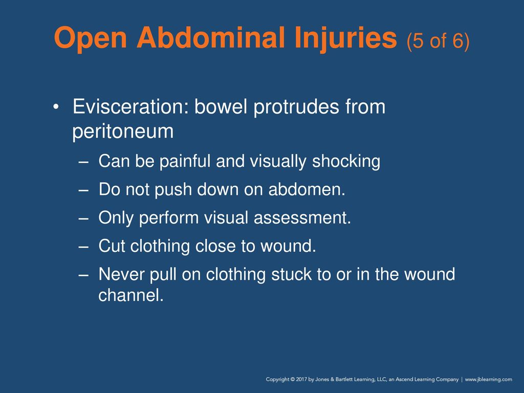 Abdominal and Genitourinary Injuries - ppt download