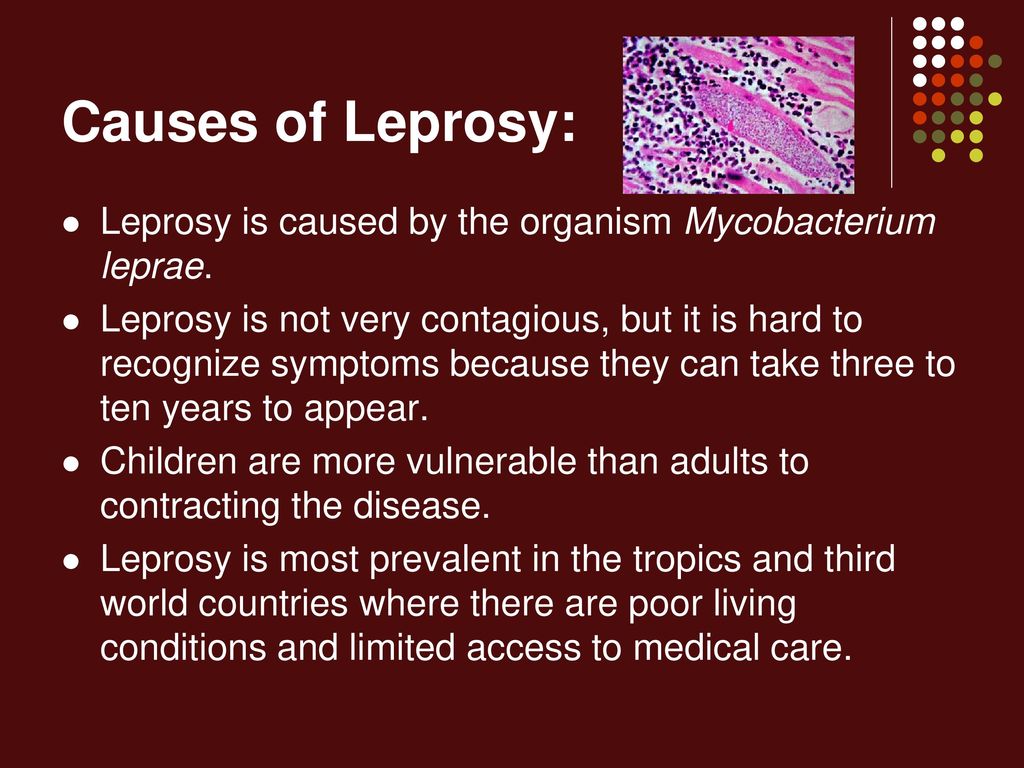 Leprosy Ppt Download