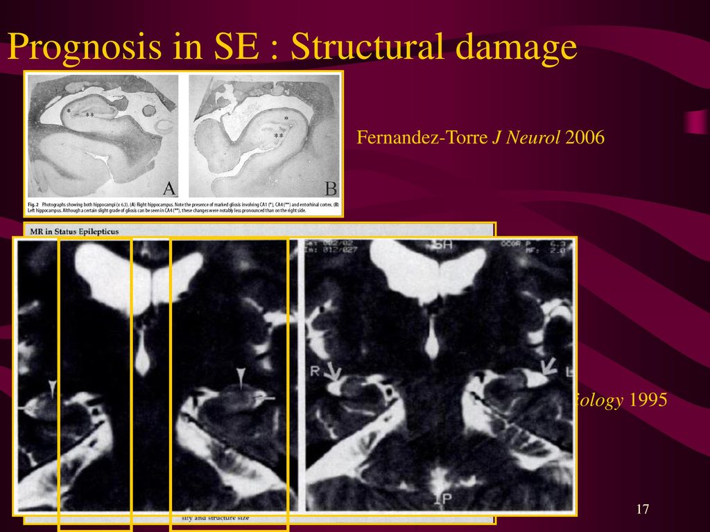 Prognosis in SE : Structural damage