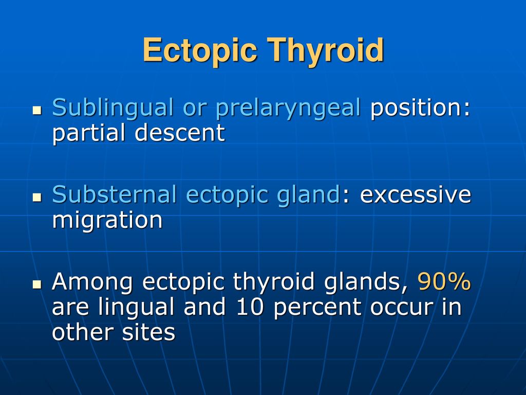 Ectopic Thyroid Gland Intern 陳君豪 2005/08/ ppt download