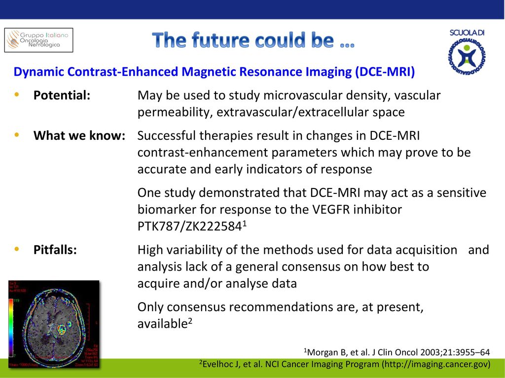 The future could be … Dynamic Contrast-Enhanced Magnetic Resonance Imaging (DCE-MRI)