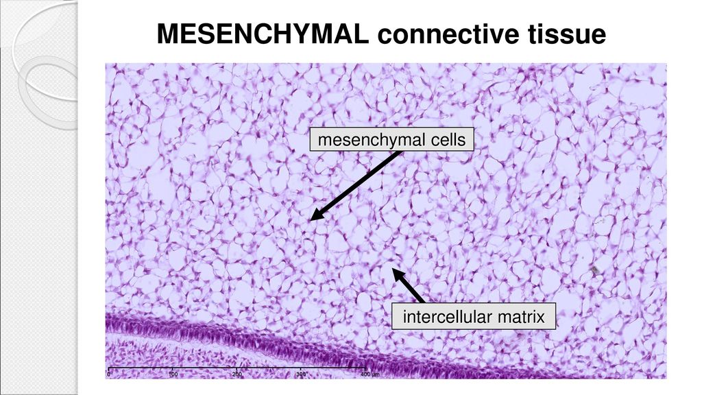 CONNECTIVE TISSUES 1 - MESENCHYMAL CONNECTIVE TISSUE - MUCOUS