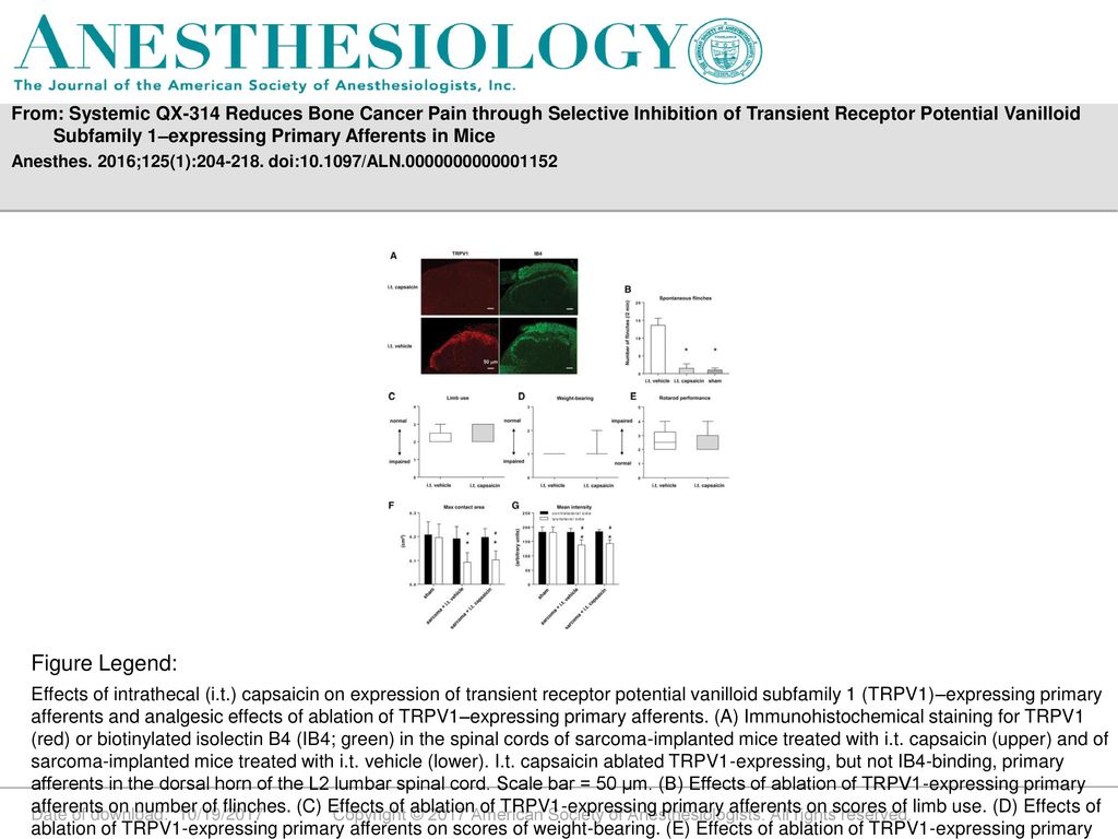From: Systemic QX-314 Reduces Bone Cancer Pain through Selective Inhibition of Transient Receptor Potential Vanilloid Subfamily 1–expressing Primary Afferents in Mice