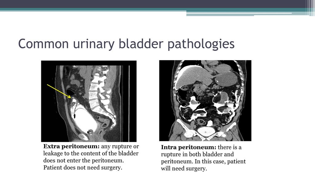 Radiology Renal System - ppt download