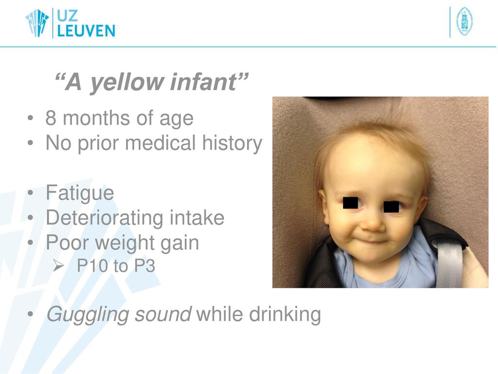 A yellow infant 8 months of age No prior medical history Fatigue